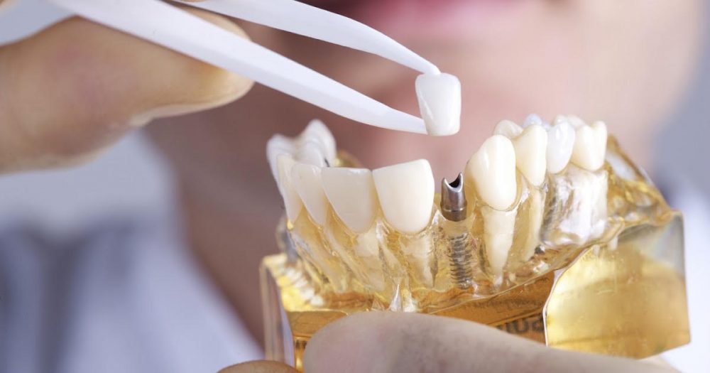 Preserve a Healthy Smile with Periodontal Maintenance
