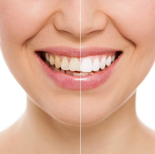oral cosmetic solutions