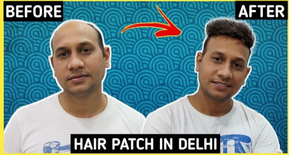 hair wig in Delhi