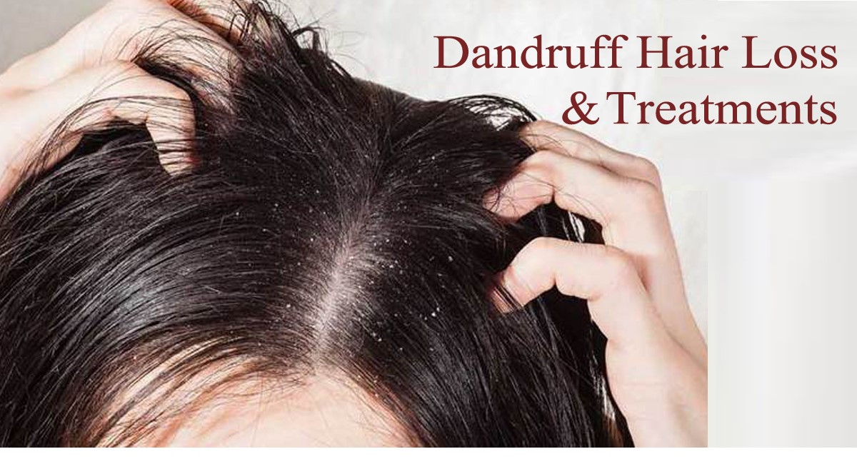 dandruff hair
