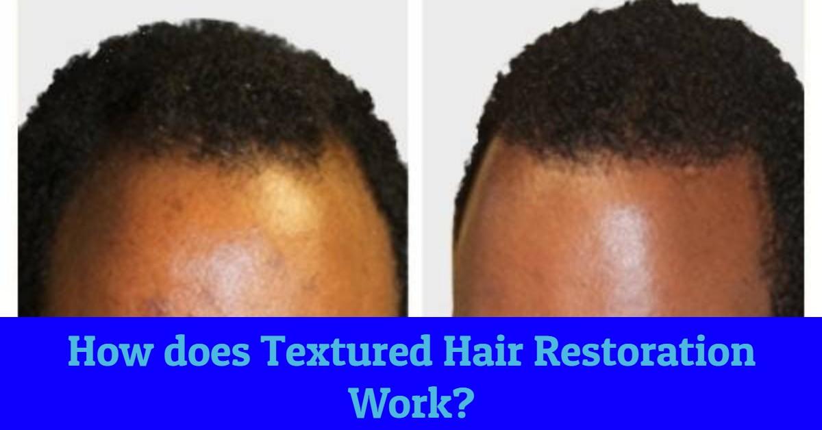 african american hair restoration