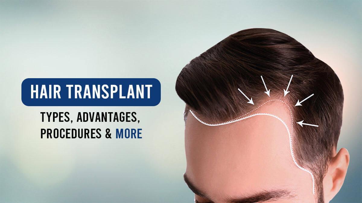 hair transplantation cost in jaipur