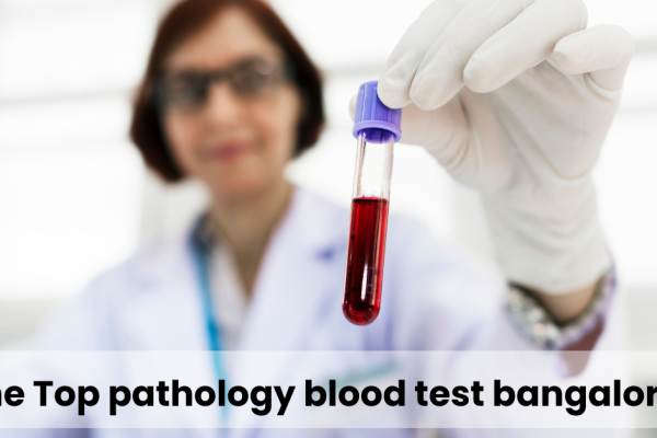 The Top pathology blood test bangalore