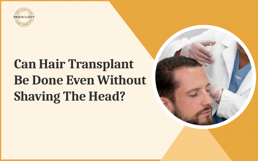Can Hair Transplant Be Done Even Without Shaving the Head?