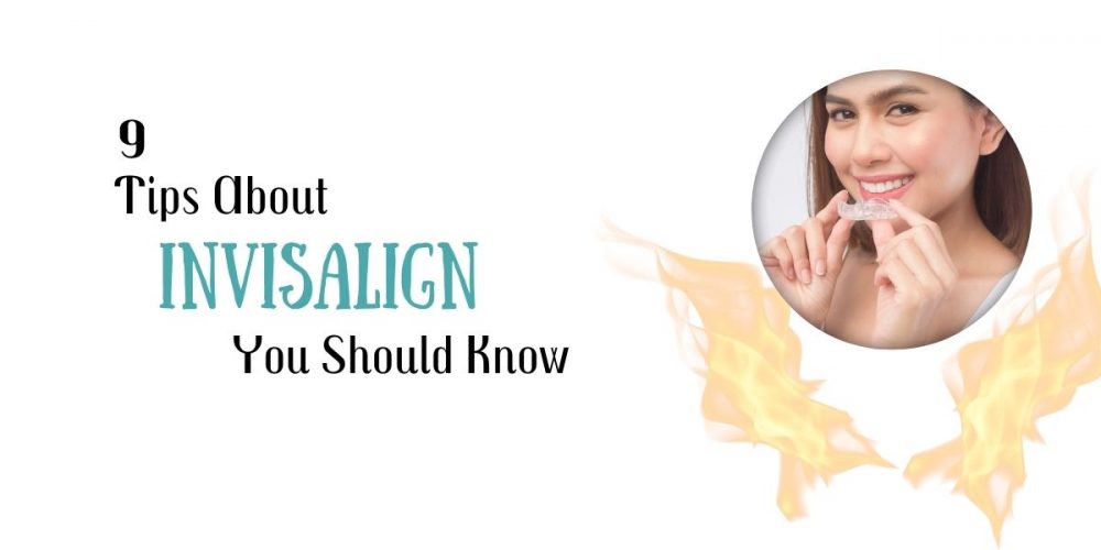 9 Tips About Invisalign You Should Know