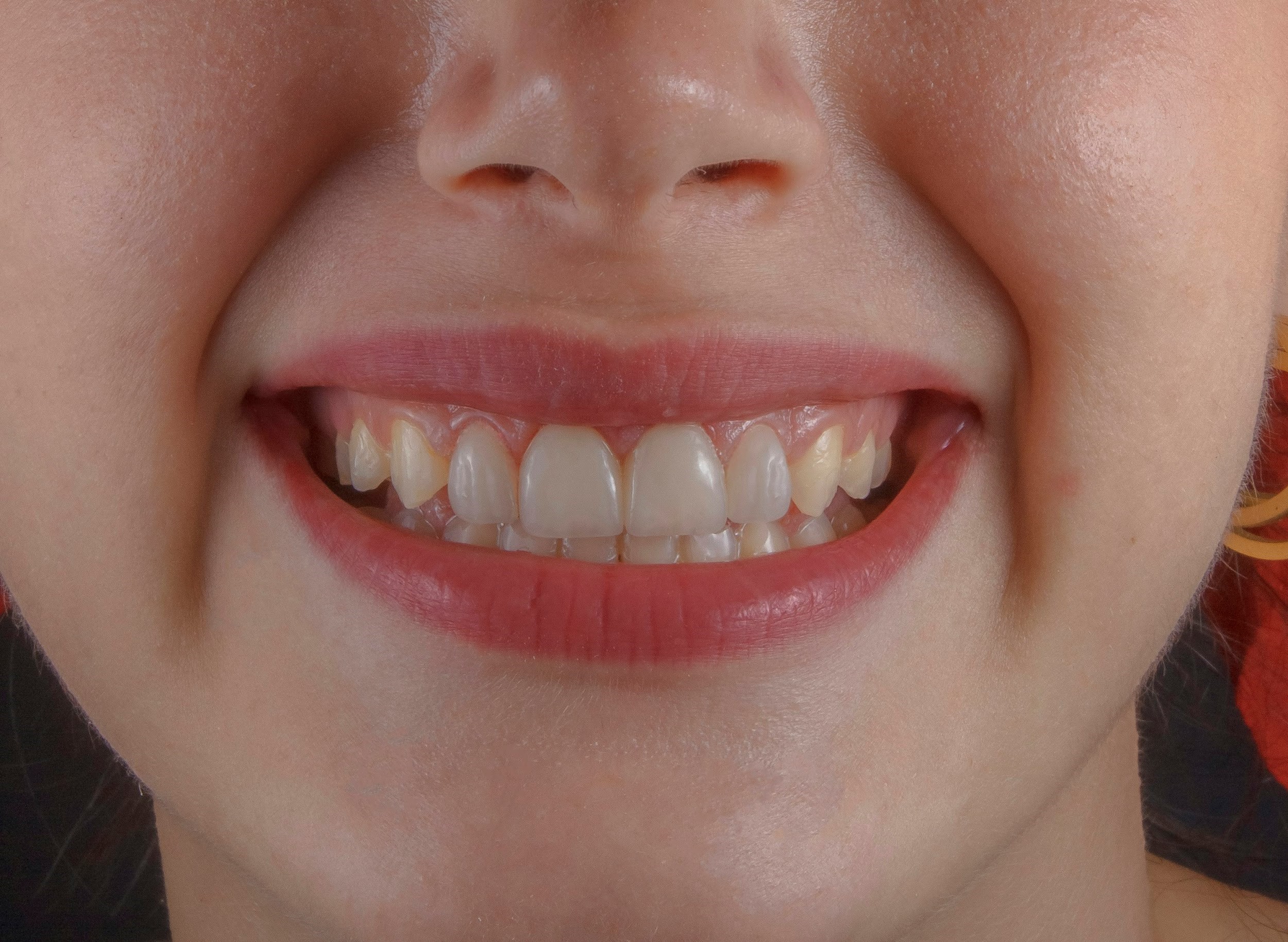 A Complete Guide to Dental Hygiene for a Brighter, Healthier Smile