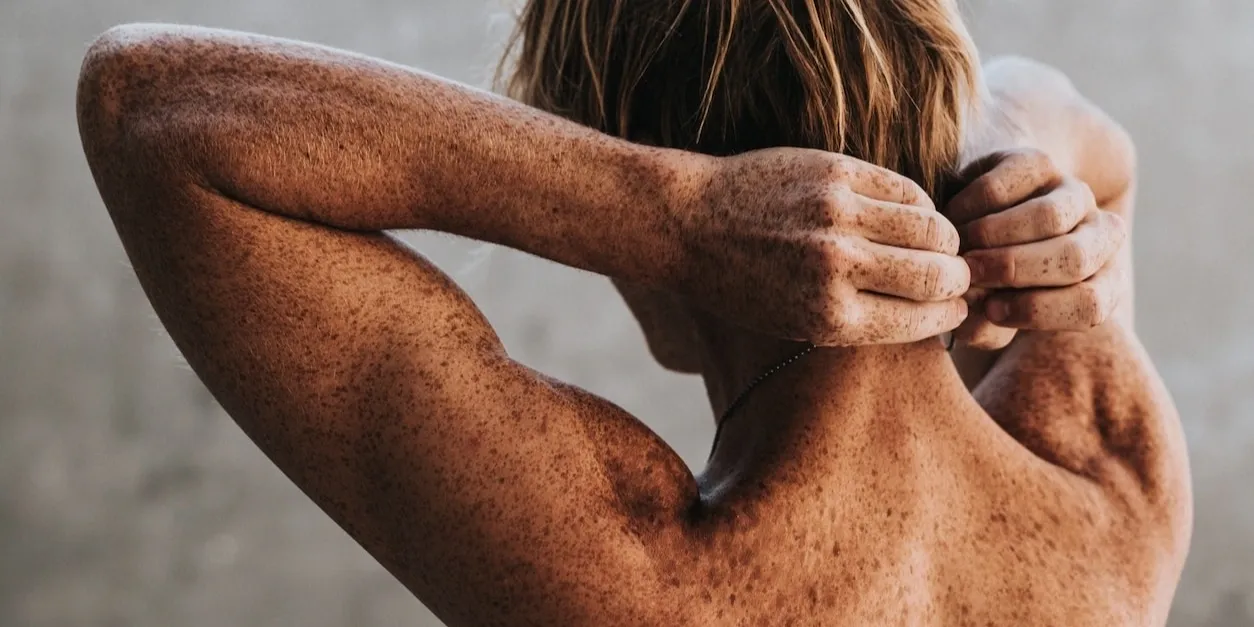 How Skin Ulcer Treatment Plans Support Faster Recovery?