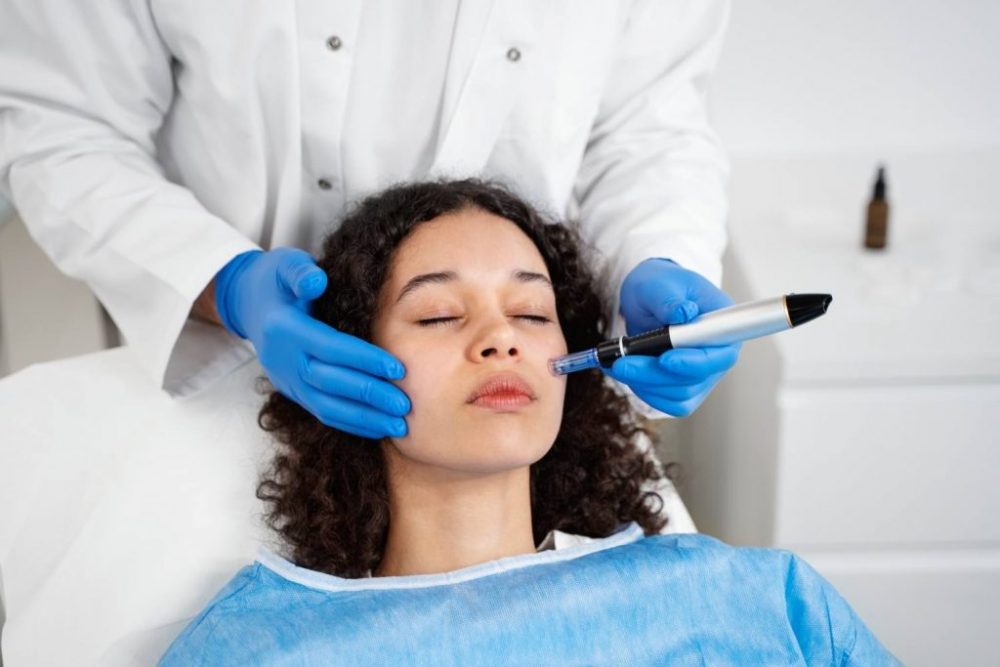 Microneedling Toronto Skin Care Guide